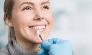 Bọc răng sứ là gì? Những điều cần biết khi bọc răng sứ thẩm mỹ