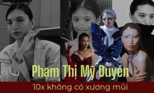 Phạm Thị Mỹ Duyên - 10x có chiếc mũi không xương bị bố của bạn học đến tận nhà chê 'như mũi khỉ'