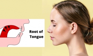 Điều kỳ diệu của phương pháp Mewing: Đẩy lưỡi lên vòm họng cũng có thể thu gọn khuôn hàm?