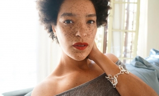 Nàng người mẫu nổi bật nhờ gương mặt tàn nhang 