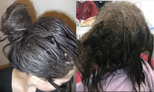 Sợ hói đầu, 1 cô gái nhịn gội trong 3 tháng, kết quả mất 11 triệu để gỡ rối