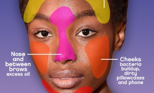 Bản đồ mặt mụn giúp xác định lý do bạn bị nổi mụn ở từng vị trí cụ thể