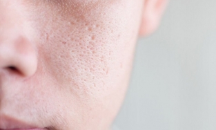 Mẹo trang điểm giúp lỗ chân lông trở nên tàng hình