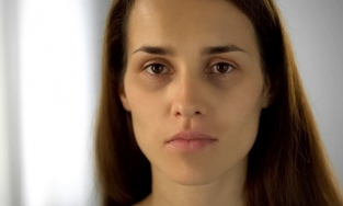 Nguyên nhân khiến mắt trũng sâu, mệt mỏi, thiếu sức sống