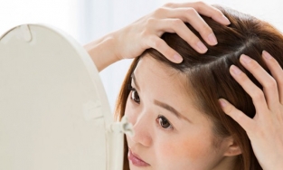 Nguyên nhân nào gây ra mụn mọc trên đầu?