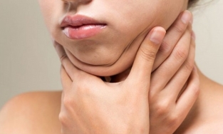 Làm sao để thoát khỏi cơn ác mộng mang tên 'nọng cằm'?