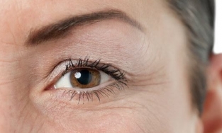 Bật mí cách giảm thiểu vết chân chim hiệu quả tại nhà