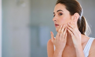 7 mẹo hay giúp bạn chăm sóc da dầu mụn tốt nhất