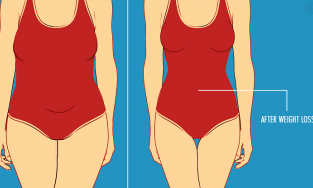 9 cách giảm cân cấp tốc nhưng vẫn an toàn cho sức khỏe