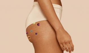 Cách trị mụn mông hiệu quả, an toàn từ chuyên gia