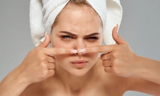 Mụn mũi thật khó chịu và đây là cách trị mụn trên mũi