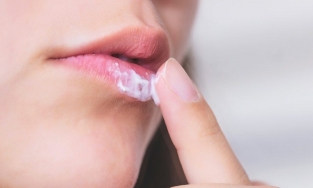 Bật mí cách trị mụn rộp ở môi cho đôi môi xinh tươi