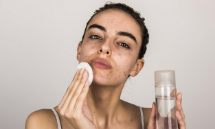 Các bước chăm sóc da mụn ban đêm ai cũng cần ghi chú