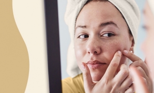 Bạn đã biết những cách trị mụn dứt điểm này hay chưa?