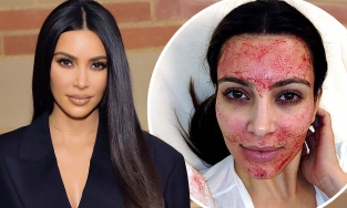 Kim Kardashian ước mình chưa bao giờ làm đẹp bằng máu 