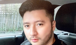 Những điều bạn cần biết trước khi muốn đi cấy râu như Trọng Hưng