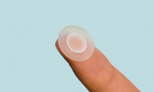 Có nên tự nặn mụn không?