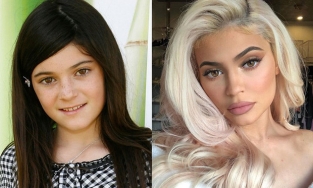 'Ngã ngửa' với loạt ảnh trước và sau 'trùng tu' của Kim Kardashian và hàng loạt sao nữ 