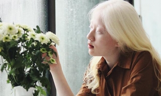 Người mẫu Việt bạch tạng đẹp như một nàng thơ 