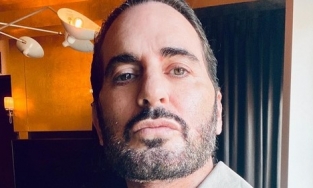 NTK Marc Jacob chi nhiều tiền để phẫu thuật nâng cơ mặt phẳng sâu