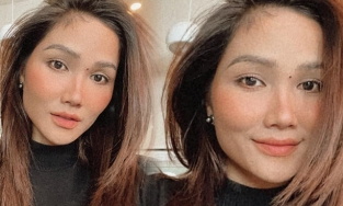 Cưng xỉu trước nốt ruồi 'pha-ke' H’Hen Niê tự tay bôi lên mặt để... trị mụn