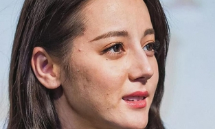 Nếu bỏ đi lớp filter thì làn da của các sao Hoa ngữ còn mịn màng?