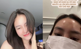 Ninh Dương Lan Ngọc thức khuya và cái 'kết đắng' dành cho làn da
