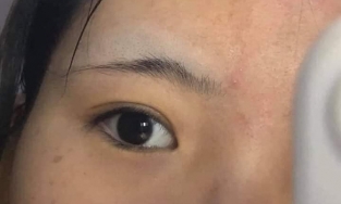 Những phương pháp làm đẹp chị em không nên thử tại nhà nếu không muốn mất Tết