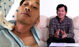 Hoài Linh tiết lộ bị u ác tuyến giáp, phải phẫu thuật cách đây 6 tháng