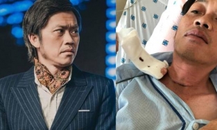 Hoài Linh đã trải qua 2 lần xạ trị, phải uống hormone hàng ngày