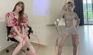 Thiều Bảo Trâm lên tiếng về đôi chân tong teo như sắp gãy