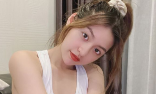 Ngoại hình của hotgirl 'trứng rán' Thanh Tâm sau khi nhổ 8 chiếc răng