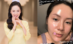 Ca sĩ Phương Linh dũng cảm công khai mặt mộc, khẳng định không sửa mũi 