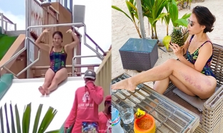 Thu Minh diện áo tắm, vô tình để lộ vết bầm bất thường dọc đùi