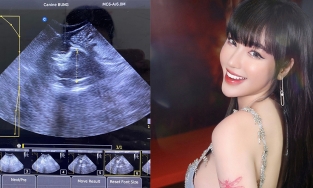 Elly Trần phủ nhận mang bầu lần 3, ảnh siêu âm thai là của mèo cưng