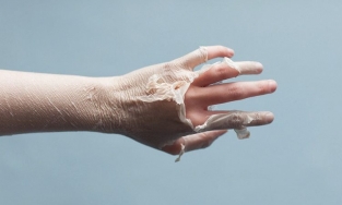 Suy nghĩ mùa đông không cần kem chống nắng là một sai lầm