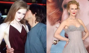 Không nhận ra 'thiên nga nước Úc' Nicole Kidman với làn da 'phát sáng' một thời