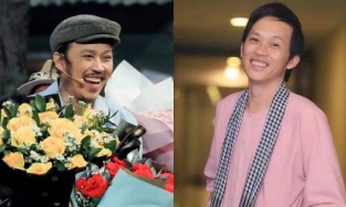 Hoài Linh bị phát hiện thay đổi 1 điểm phong thủy trên gương mặt trong ngày tái xuất 