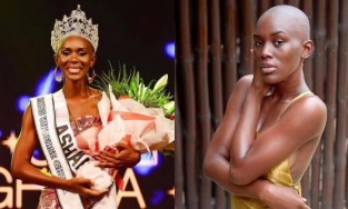Thêm một mỹ nhân không có tóc đăng quang Hoa hậu Hoàn vũ Ghana 2022 