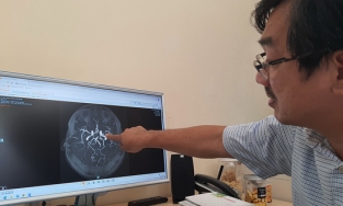 Bé 3 tuổi bị đột quỵ, bác sĩ chỉ ra nguyên nhân