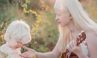 Ngỡ ngàng trước vẻ đẹp của cặp chị em gái bạch tạng