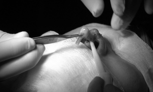 Lâm Đồng: Đứt trụ mũi do 'bác sĩ Sài Gòn' đến nhà nâng mũi thẩm mỹ