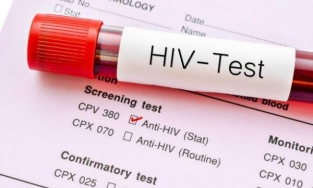Phát hiện mắc bệnh HIV từ triệu chứng chảy máu hậu môn