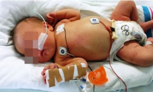 Trẻ 10 ngày tuổi mất mạng chỉ vì cha mẹ không rửa tay trước khi cho con ăn