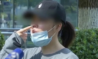 Người phụ nữ nhận lại chiếc mũi có 4 lỗ sau khi bỏ 70 triệu để thẩm mỹ