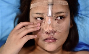 Nhiều người trẻ Trung Quốc vay nợ tân trang nhan sắc cho giống trên mạng