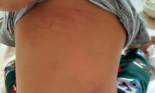 Ninh Bình: Trẻ 15 tháng bị cô giáo đánh trong nhà vệ sinh, 1 cô đứng nhìn