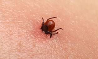 Cụ bà 79 tuổi nguy kịch do bị mò đốt