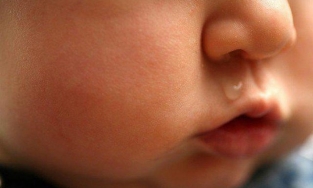 Trẻ chảy nước mũi màu xanh, vàng có phải là nhiễm vi khuẩn, phải sử dụng kháng sinh?