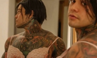 Không phải người chuyển giới, nam thanh niên vẫn đi cấy ngực để... giải trí